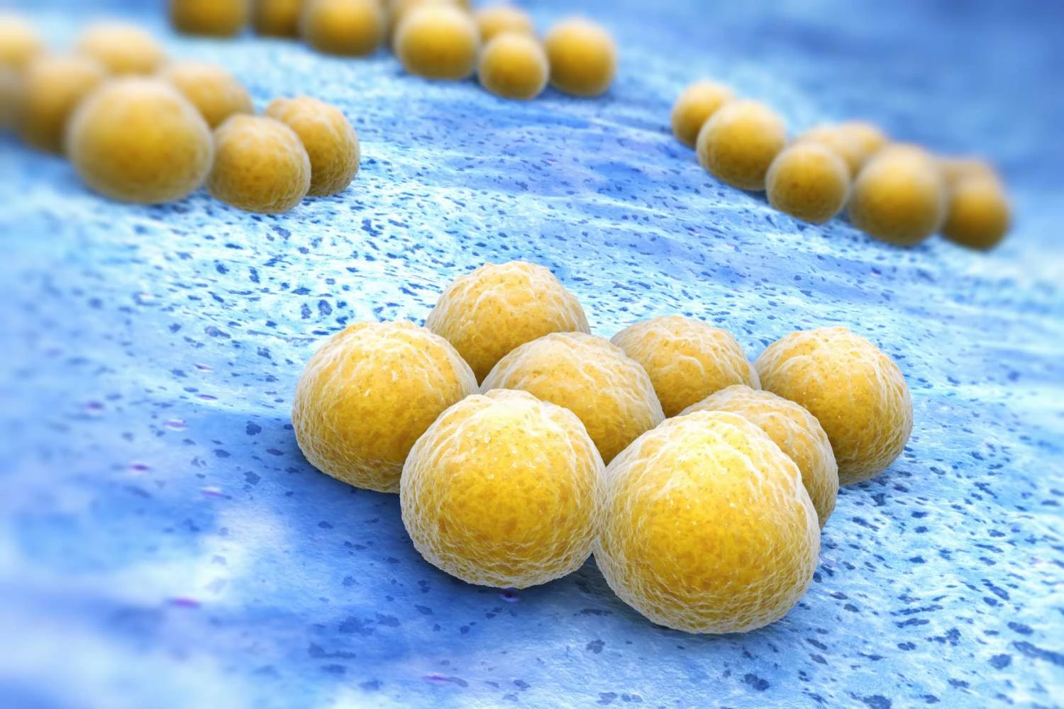 تصویری از استافیلوکوکوس اورئوس مقاوم به متیسیلین (MRSA)