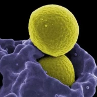 سلول سیستم ایمنی به نام نوتروفیل (بنفش) باکتری MRSA (زرد) را بلعیده است.