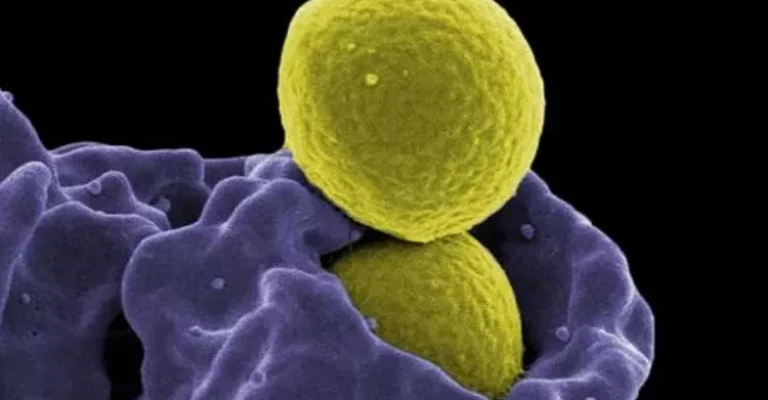 سلول سیستم ایمنی به نام نوتروفیل (بنفش) باکتری MRSA (زرد) را بلعیده است.