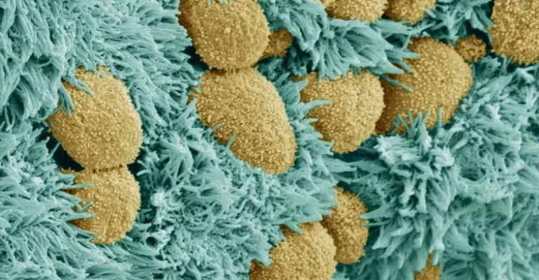 سلول‌های اپندیمی