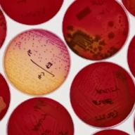 کشت باکتری در ژل آگار قرمز در ظروف پتری