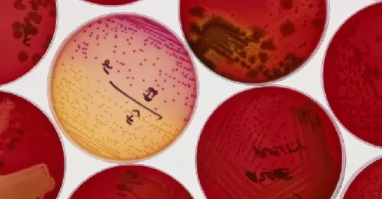 کشت باکتری در ژل آگار قرمز در ظروف پتری