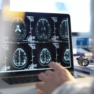 اسکن مغز انسان