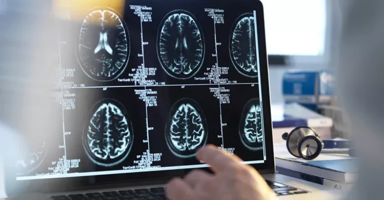 اسکن مغز انسان